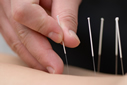 Long Island Acupuncturists Infertility Specialists